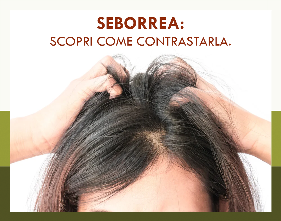 La seborrea: cos'è e come agire!